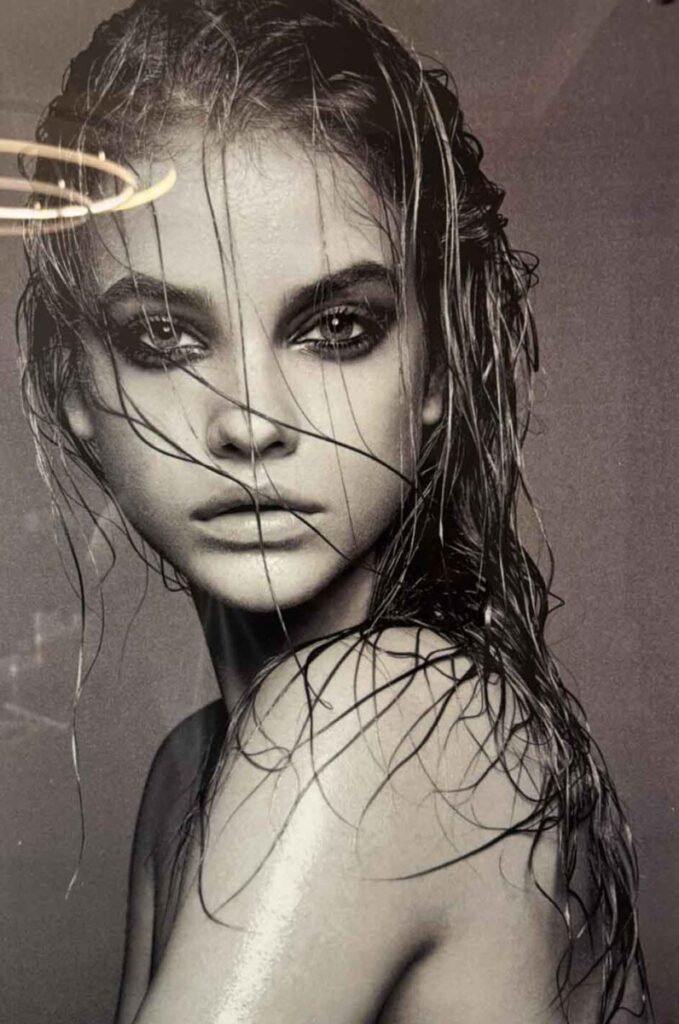 ninas laser toumpa thessaloniki laser apotrixosi image2