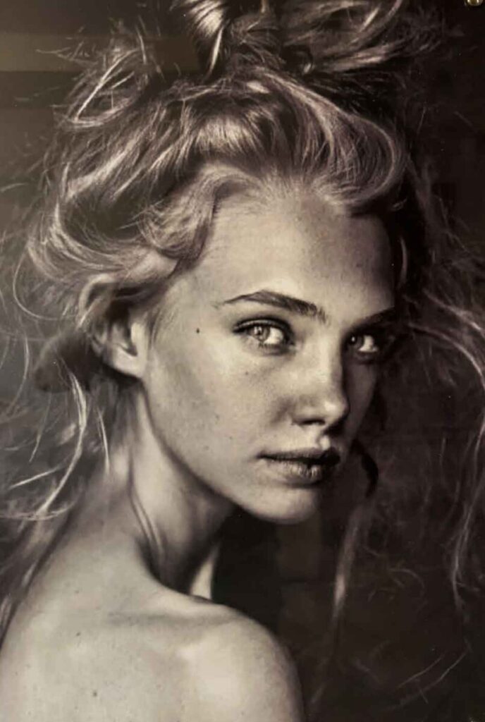 ninas laser toumpa thessaloniki therapia matiwn 3